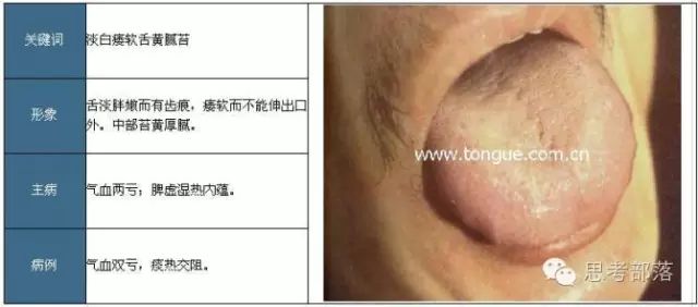 Comprehensive Guide to Tongue Diagnosis (8): 72 Types of Tongue Diagnosis Charts