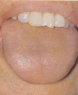 The Health Code Hidden on Your Tongue