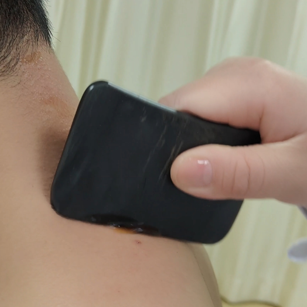 Understanding Dampness in Traditional Chinese Medicine: Effective Methods to Eliminate Dampness