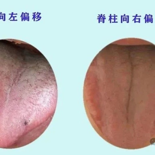 Diagnosis Based on Tongue Color
