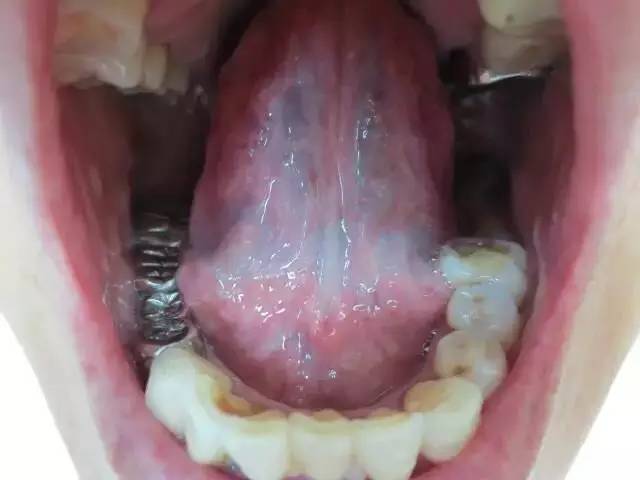 Exploring Tongue Diagnosis in Traditional Chinese Medicine: Hidden Insights and Tongue Diagnosis Atlas