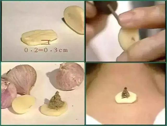 What Are the Classifications of Moxibustion?