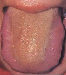 62 High-Definition Tongue Diagnosis Charts with Illustrations (Collector's Edition)