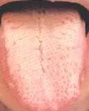 Comprehensive Guide to Tongue Diagnosis: Easily Understand Your Health Condition