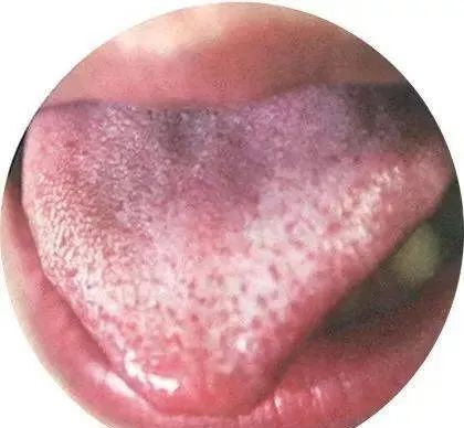 130 High-Definition Tongue Diagnosis Charts (Recommended for Collection)