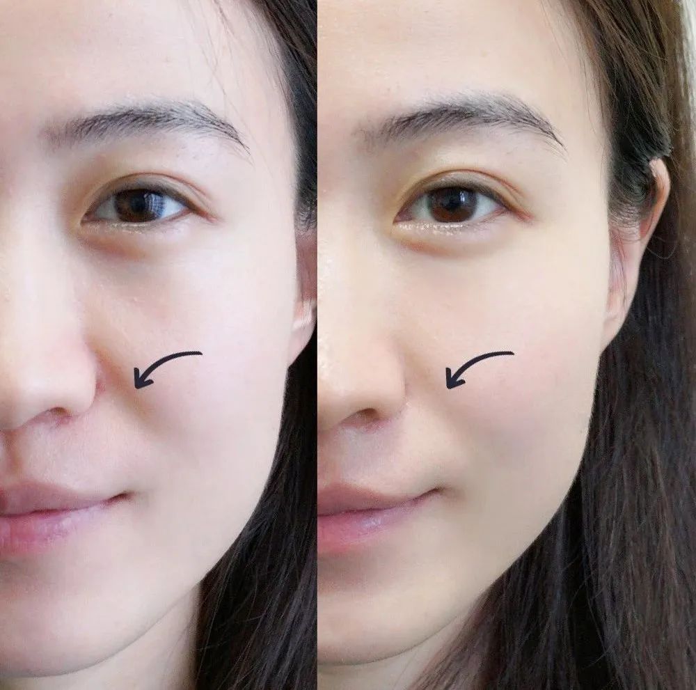 The Secret Gua Sha Technique of Celebrities for a Slim Face and Tight Skin