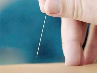 Understanding Acupuncture: Debunking Myths and Exploring Mechanisms