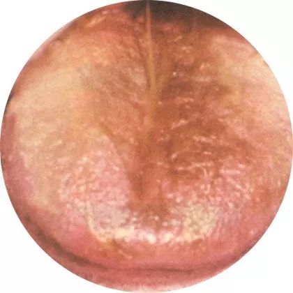 The Most Comprehensive High-Definition Real Tongue Diagnosis: Observing Tongue Patterns to Understand Internal Organs (Collection Edition)
