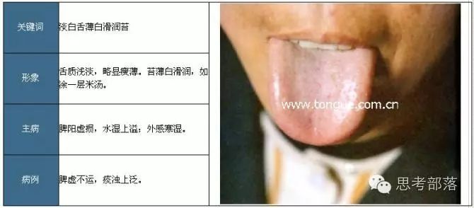 Comprehensive Guide to Tongue Diagnosis (8): 72 Types of Tongue Diagnosis Charts