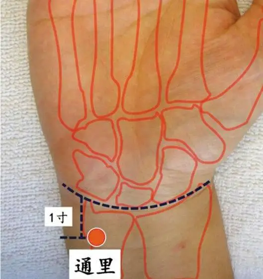47 Unique Acupuncture Points Worth Seeing! (Collector's Edition)