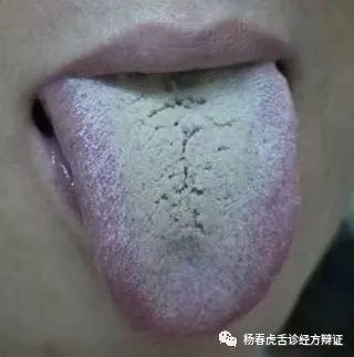 Foundations of Traditional Chinese Medicine: Phlegm-Dampness