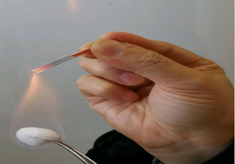 The Marvelous Technique of Fire Needle Therapy in Traditional Chinese Medicine