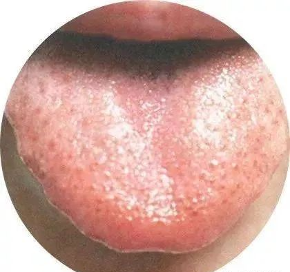 130 High-Definition Tongue Diagnosis Charts (Recommended for Collection)
