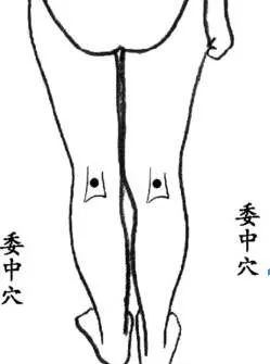 Definition and Functions of Bloodletting in Traditional Chinese Medicine