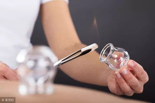 The Art of Cupping in Traditional Chinese Medicine: 5 Contraindications and Analysis of Cupping Marks