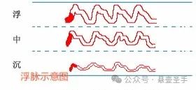 Floating Pulse: Body Image, Main Diseases, and Associated Pulses