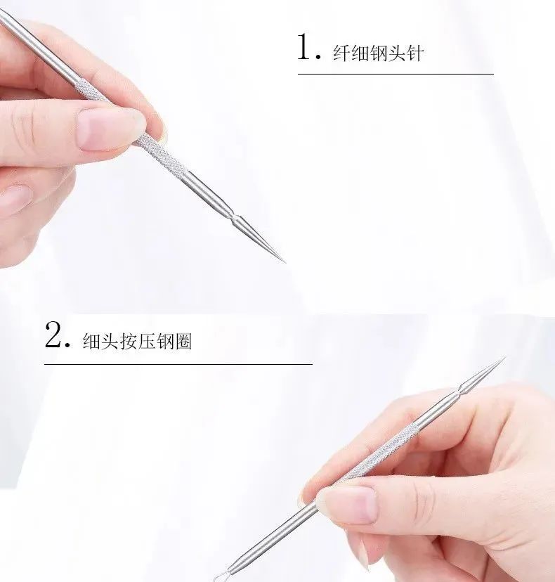Understanding Needle Cleansing and Fire Needle Therapy in Acne Treatment