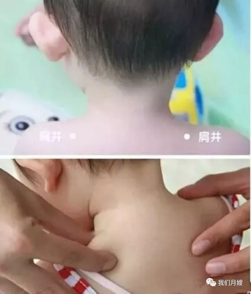 21 Techniques of Pediatric Tuina: Simple and Easy to Learn with Animated Demonstrations