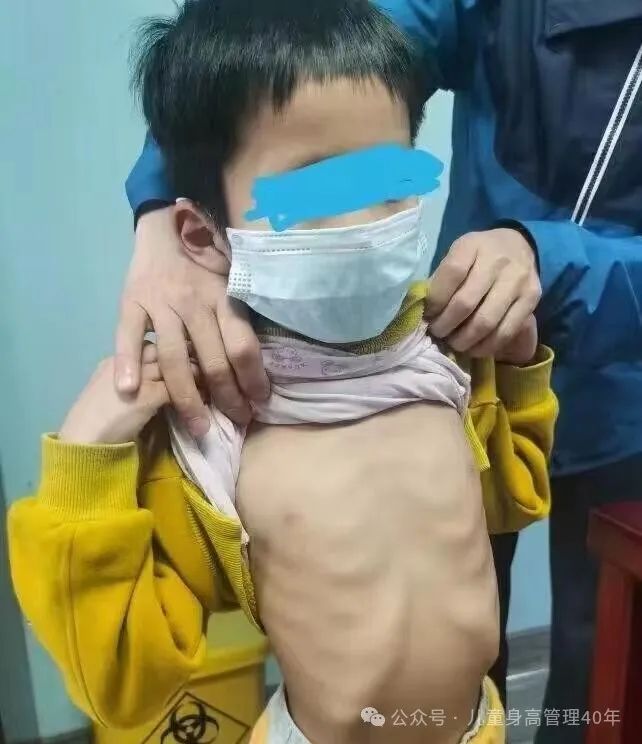 Boosting Qi and Blood in Children: A Simple Recipe with Longan and One Other Ingredient!