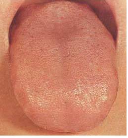 62 High-Definition Tongue Diagnosis Charts with Illustrations (Collector's Edition)