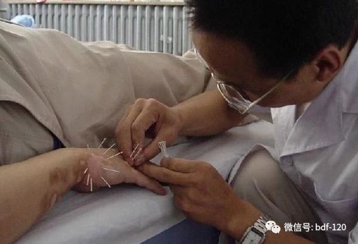 External Treatment Methods of Traditional Chinese Medicine for Vitiligo