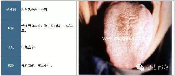 Comprehensive Guide to Tongue Diagnosis (8): 72 Types of Tongue Diagnosis Charts