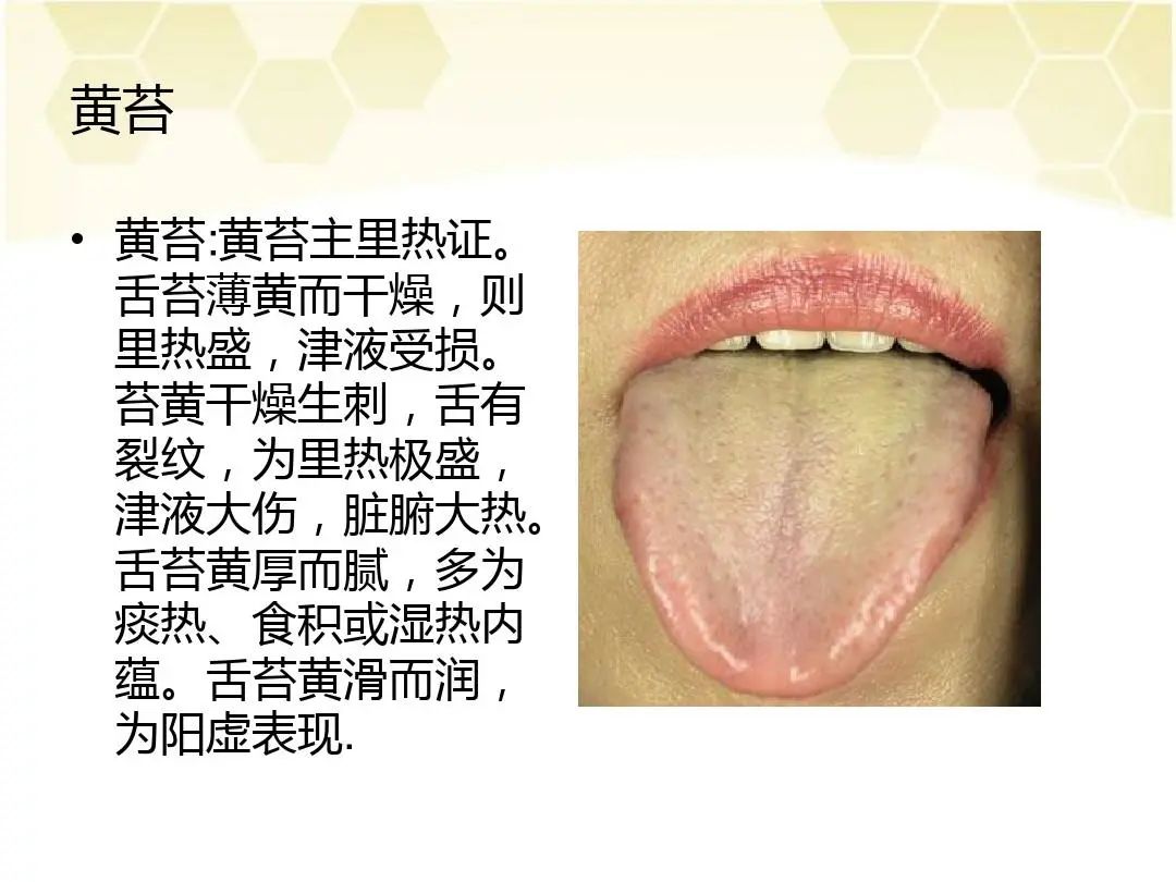 Tongue Coating Diagnosis in Traditional Chinese Medicine