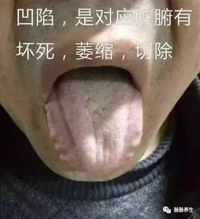 Tongue Diagnosis: A Clear Insight