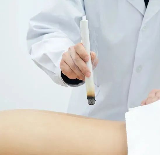 Moxibustion for Qi Regulation and Meridian Unblocking: Dispelling Wind, Expelling Cold, and Nourishing Yang Qi