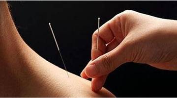 Acupuncture Techniques (A Must-Read for Acupuncturists)