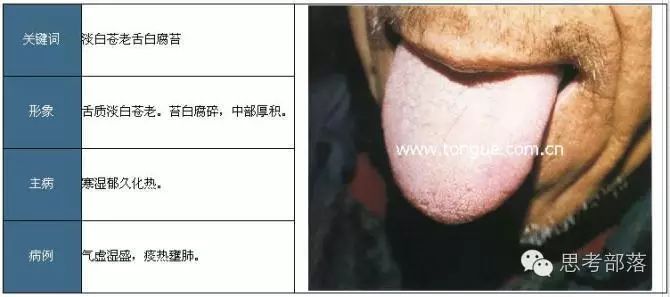 Comprehensive Guide to Tongue Diagnosis (8): 72 Types of Tongue Diagnosis Charts