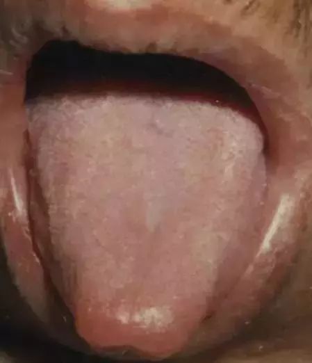 The Most Comprehensive Guide to Tongue Diagnosis! Master It and Become a Tongue Diagnosis Expert