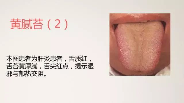 The Most Comprehensive TCM Tongue Diagnosis Atlas: Observe the Tongue, Understand the Whole Body!