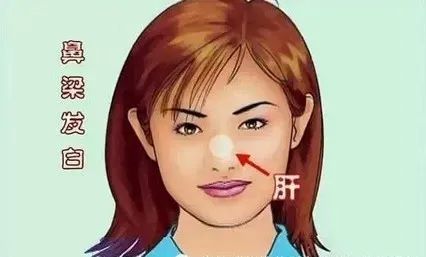 Comprehensive Guide to Facial Diagnosis in Traditional Chinese Medicine (With Images and Explanations)