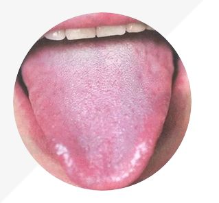 Analysis of High-Definition Tongue Diagnosis Charts: Understanding Health Through Your Tongue (Part 1)