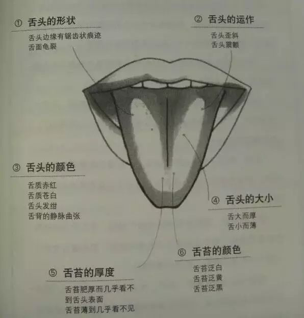 Essential Guide to TCM Observation Diagnosis: Easy to Understand (Recommended for Collection)
