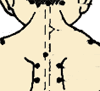 Comprehensive Pediatric Tuina Techniques for Common Illnesses