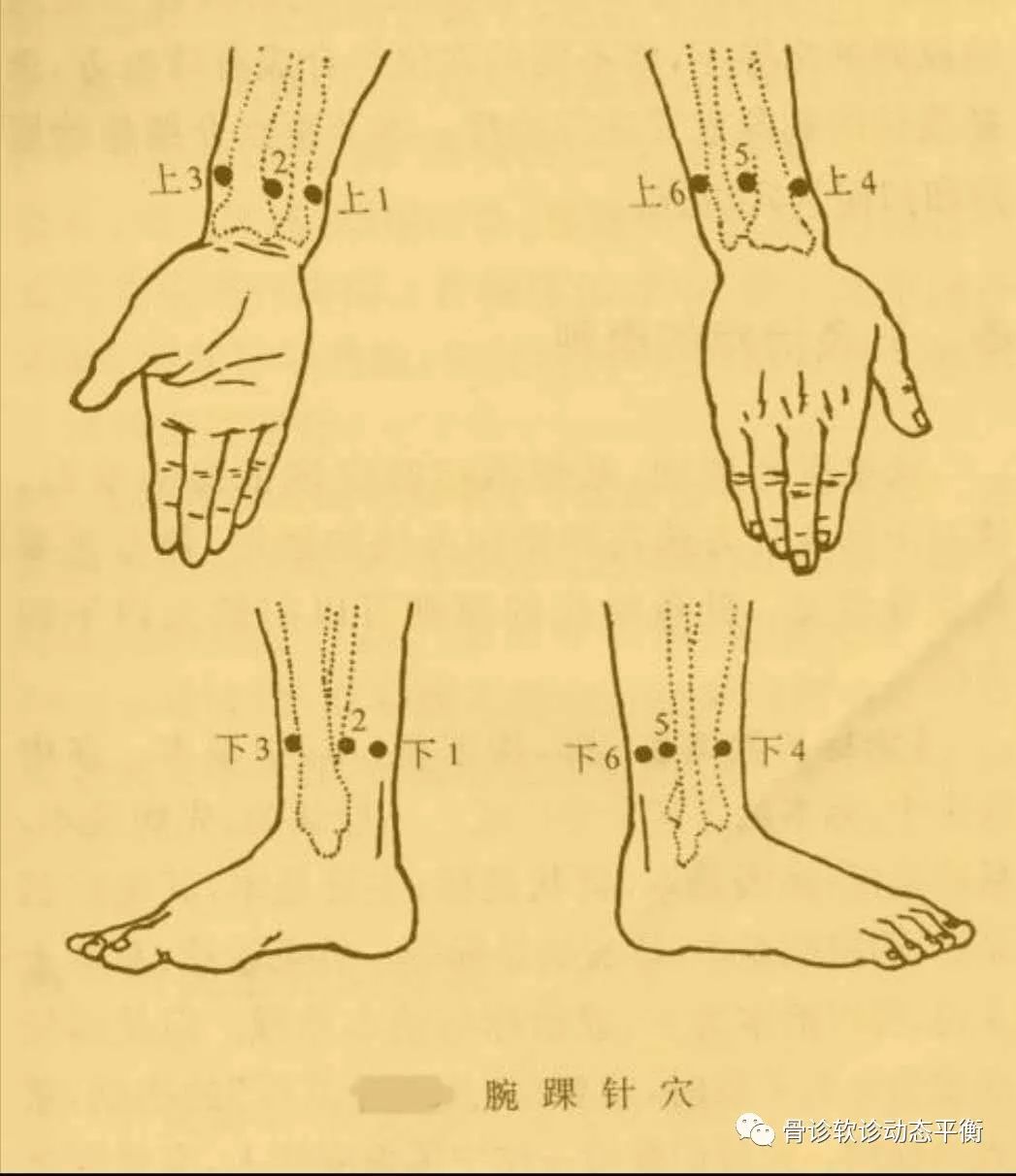 The Scope and Boundaries of the Efficacy of Fine Needling