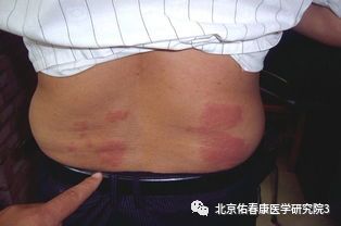 Traditional Chinese Medicine "Gaoji" (Pastes)