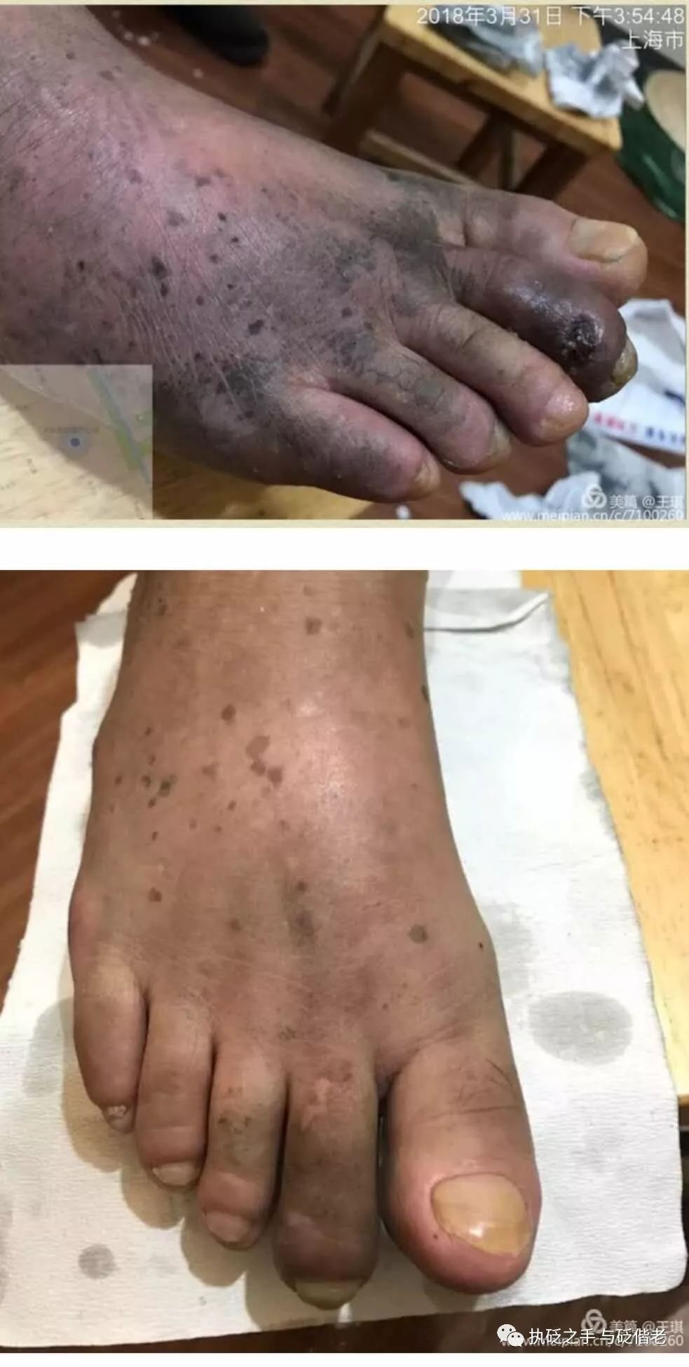Black Sha: The Surprising Discovery of Copper Gua Sha