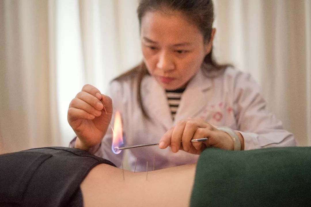 Acupuncture Techniques to Alleviate Shingles Pain