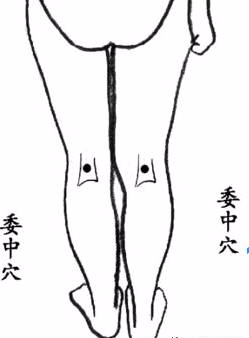 Detailed Explanation of Bloodletting at Acupuncture Points for Different Diseases