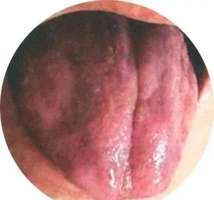 130 High-Definition Tongue Diagnosis Charts (Recommended for Collection)