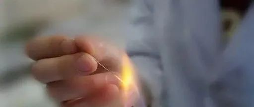 Dermatology: TCM Fire Needle Technique for Treating Skin Diseases
