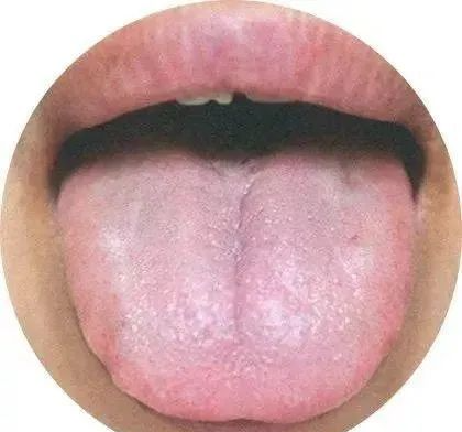 130 High-Definition Tongue Diagnosis Charts (Recommended for Collection)