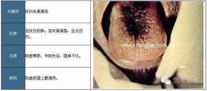 Comprehensive Guide to Tongue Diagnosis (8): 72 Types of Tongue Diagnosis Charts
