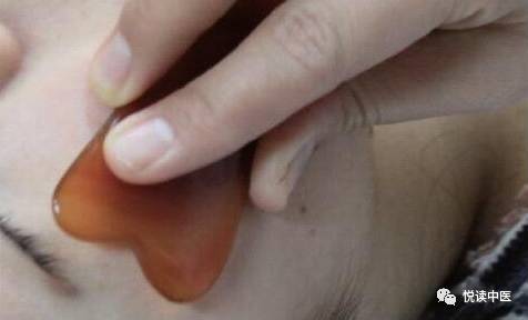 Understanding Gua Sha Techniques: Priceless Illustrations You Can't Miss!