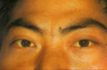 Traditional Chinese Medicine Diagnosis | Observation Diagnosis - Observing Color