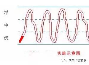 Pulse Diagnosis: Xu Mai (Deficient Pulse) and Shi Mai (Excess Pulse)