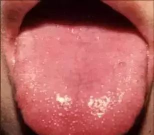 The Most Comprehensive Guide to Tongue Diagnosis! Master It and Become a Tongue Diagnosis Expert